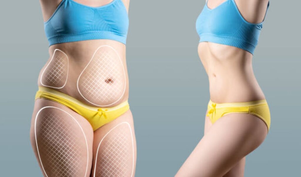 How to Reduce Thigh Fat at Home