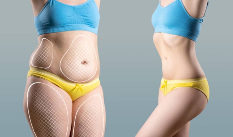How to Reduce Thigh Fat at Home